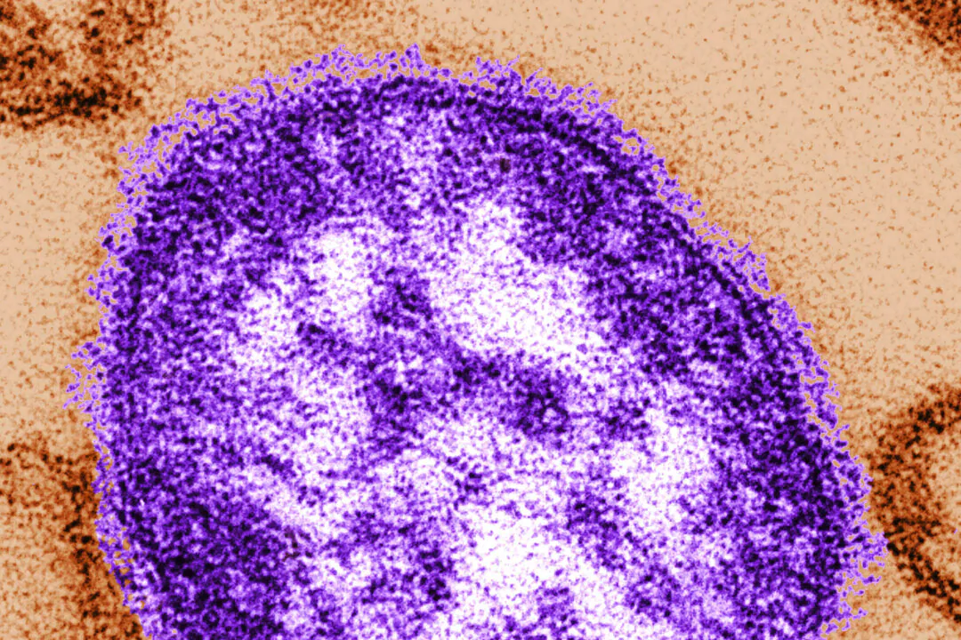 An electron microscope image of a measles virus particle provided by the Centers for Disease Control and Prevention on Feb. 4, 2015. (Cynthia Goldsmith/Centers for Disease Control and Prevention via AP)