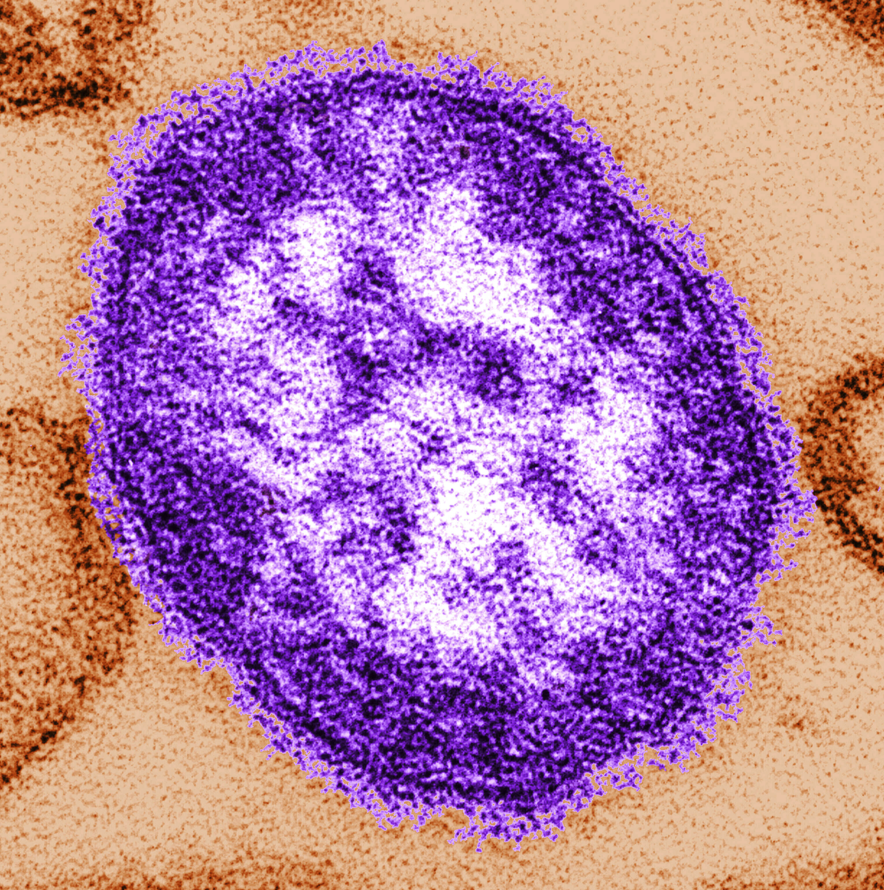 Measles-explainer