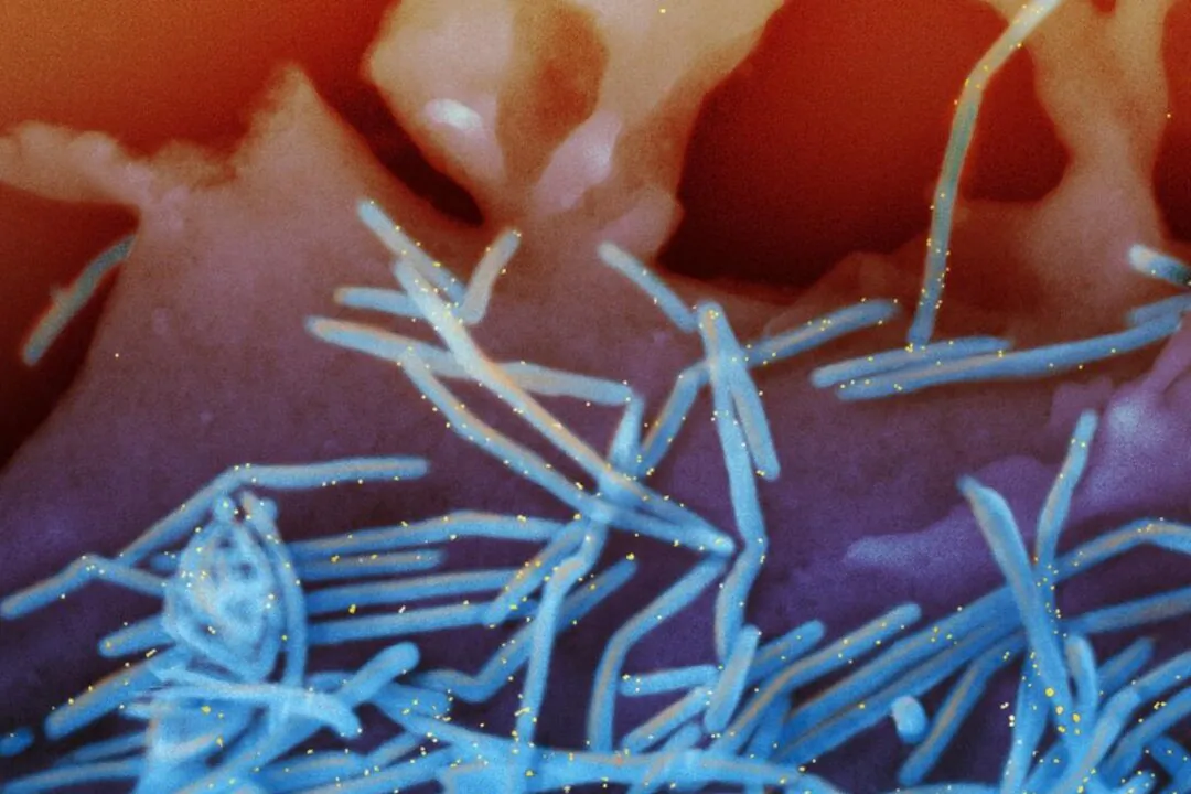 A colorized scanning electron micrograph shows human respiratory syncytial virus (RSV) virions shedding from human lung epithelial cells. (NIAID via The Epoch Times)