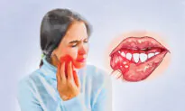 Canker Sores: Symptoms, Causes, Treatments, and Natural Approaches