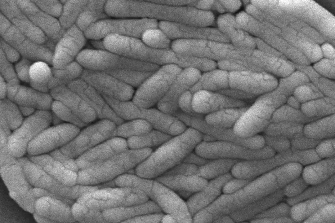 A large group of Gram-negative Salmonella typhimurium bacteria that had been isolated from a pure culture in 2009. (Janice Haney Carr/CDC via AP)