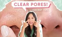 My No-Fail Routine for Blackheads, Large Pores, and Acne (Feat. Beauty of Joseon)