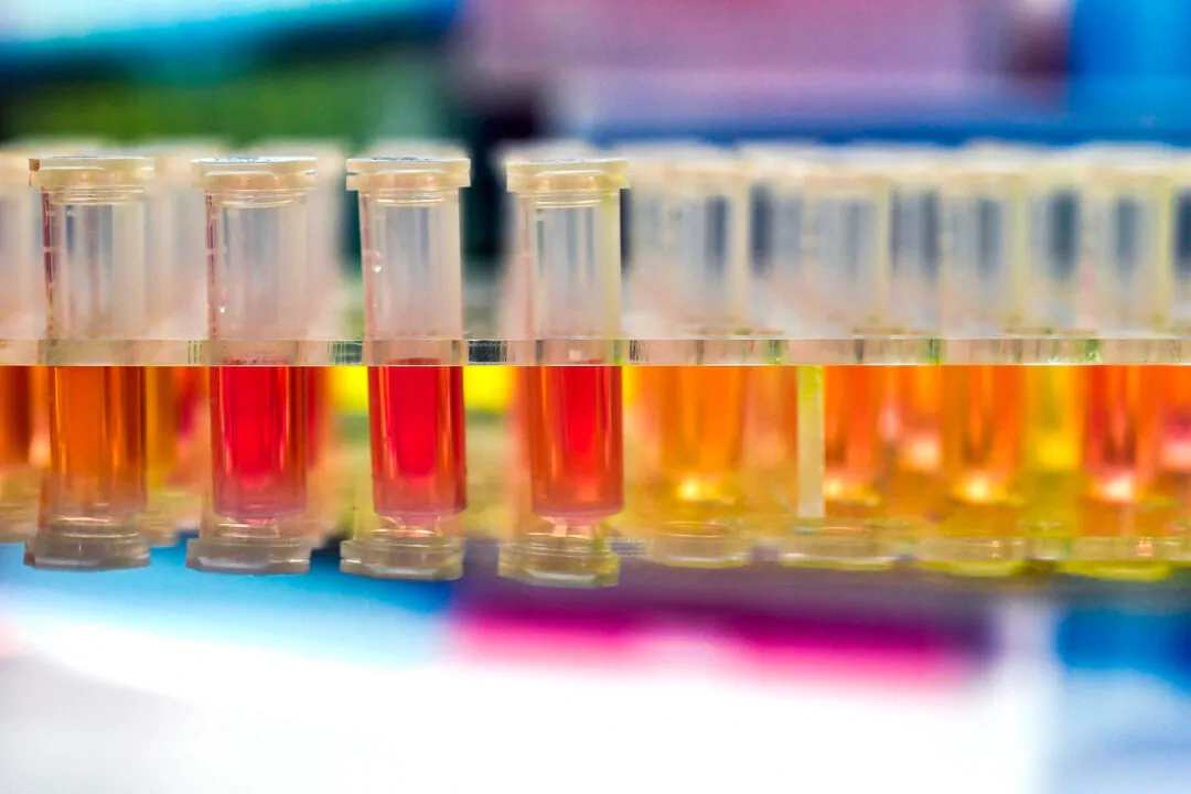 Samples from people to be tested for the new coronavirus at a laboratory in Wuhan, China. (STR/AFP via Getty Images)