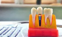 Missing Teeth, Big Consequences: When and How to Restore Your Smile