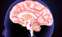 Obesity in Teens Linked to Enlarged Brain Regions Associated With Memory and Emotion