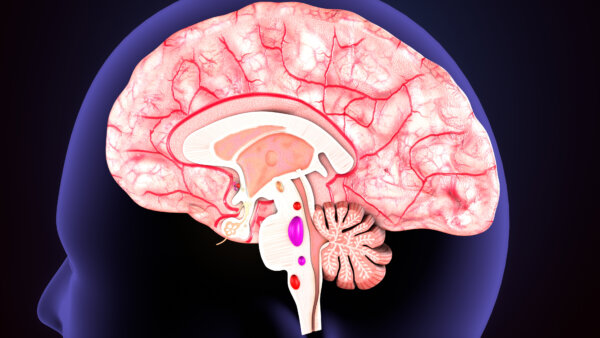 Obesity in Teens Linked to Enlarged Brain Regions Associated With Memory and Emotion