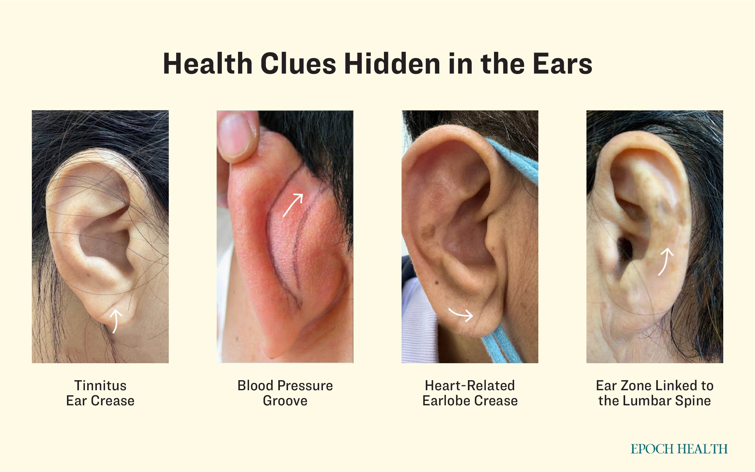 Health clues hidden in the ears. (Courtesy of Hung-Chien Wu)