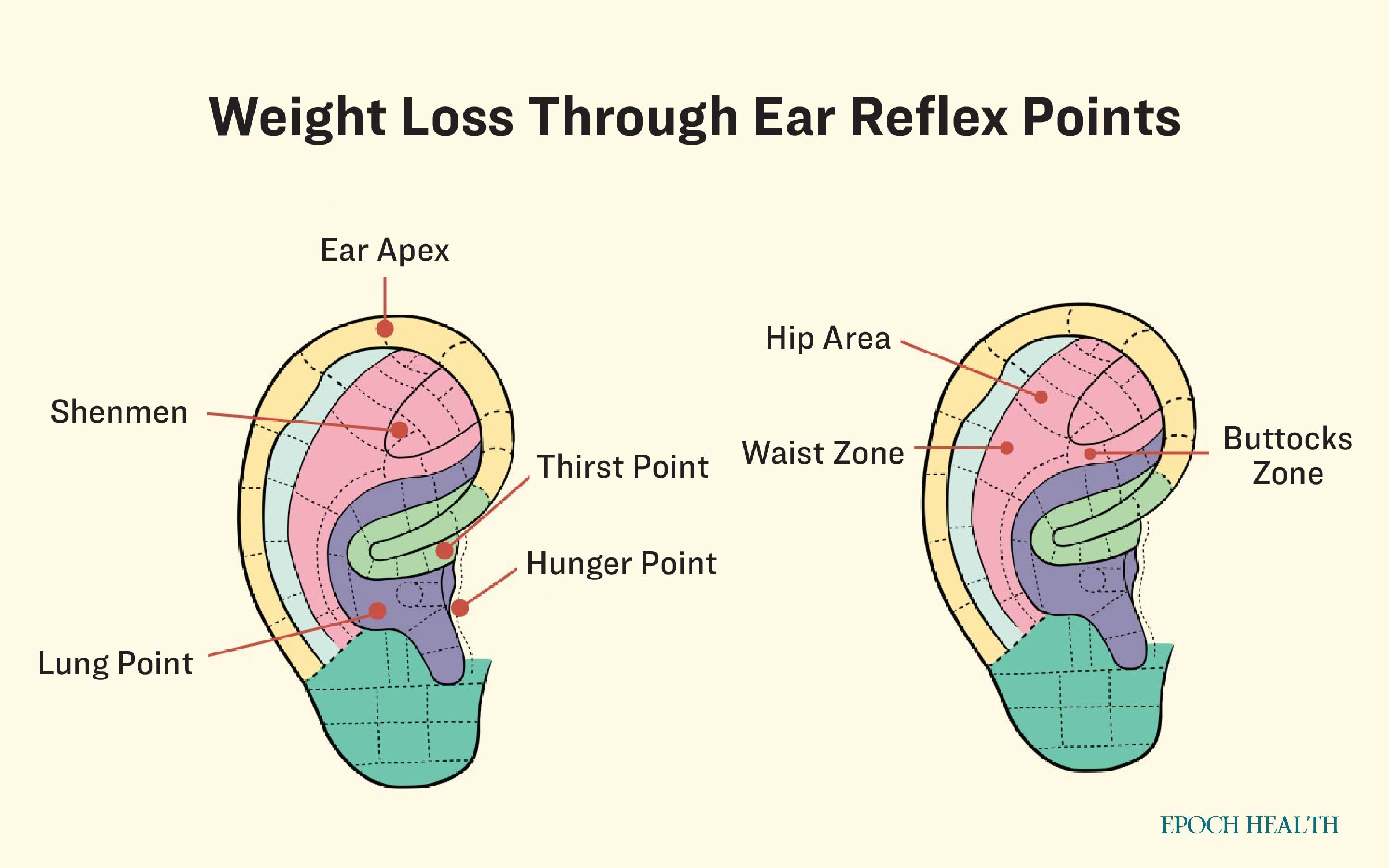 Weight loss through ear reflex points. (The Epoch Times)