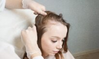How Women Can Prevent Hair Loss by Nourishing the Liver and Kidneys