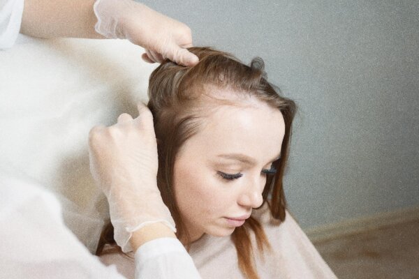 How Women Can Prevent Hair Loss by Nourishing the Liver and Kidneys