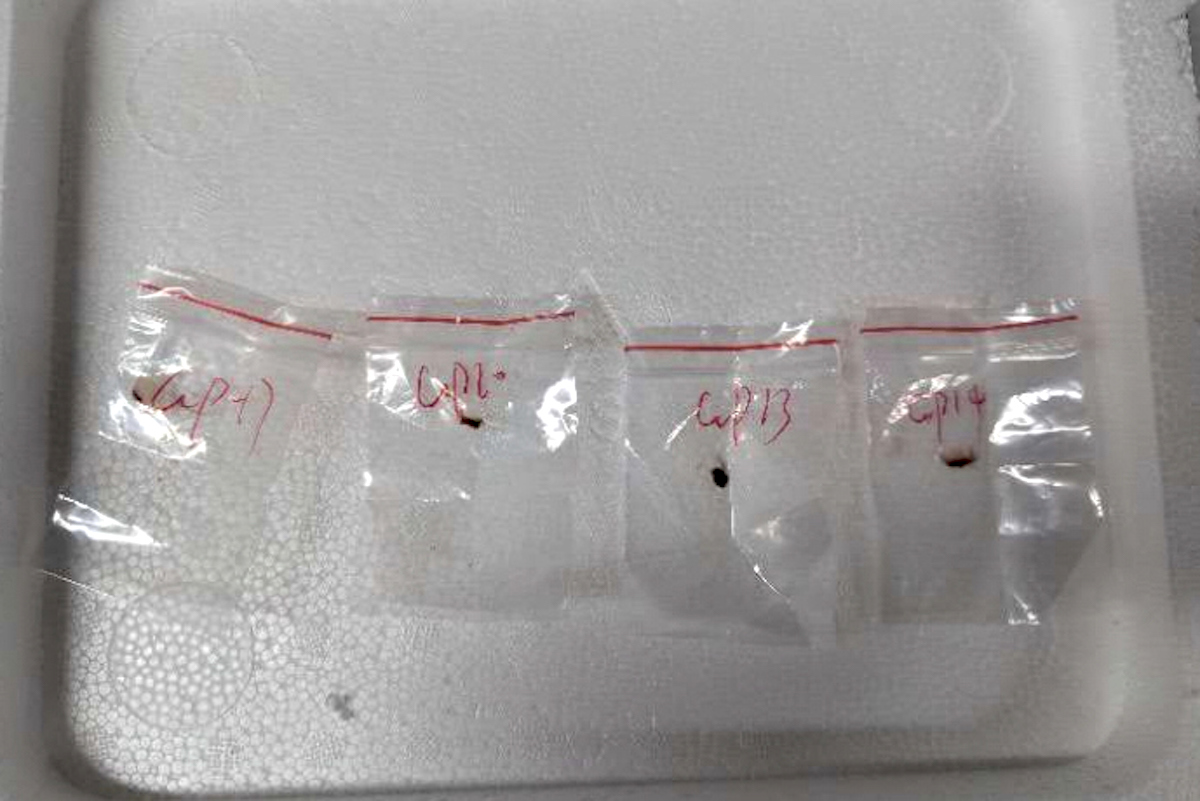 In 2024, a Chinese scientist entered the United States with these toxic plant pathogens stashed in his backpack, federal authorities said on June 3, 2025, as they filed charges against him and a girlfriend who worked in a University of Michigan lab. (United States District Court For The Eastern District Of Michigan via AP)