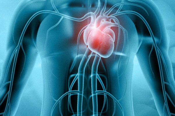 Sedentary Behavior After Heart Attack Increase Risk of Another