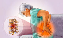 Sciatica: A Common Painful Condition Affecting the Largest Nerves, 4 Natural Approaches to Relieve It