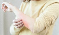 Effective Natural Remedies for Itchy Skin: A Traditional Approach to Relieving Discomfort