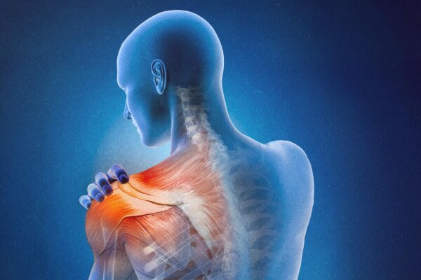 Beyond Pills and Surgery: Holistic Options for Frozen Shoulder Treatment