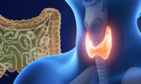 A Sluggish Thyroid May Be Linked to Gut Health—Here’s How to Improve It