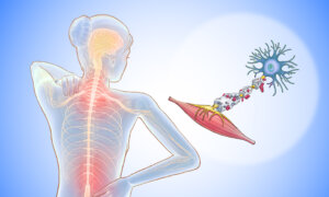 Multiple Sclerosis: A Debilitating Autoimmune Disease and Its Early Signs