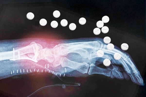 Study Finds Unexpected Rebound Risk After Hormone Therapy