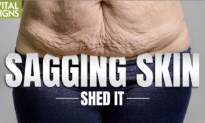 Best Weight Loss Plan to Cut Flabby Skin, Keep Muscle, Stay Thin?