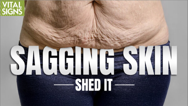 Best Weight Loss Plan to Cut Flabby Skin, Keep Muscle, Stay Thin?