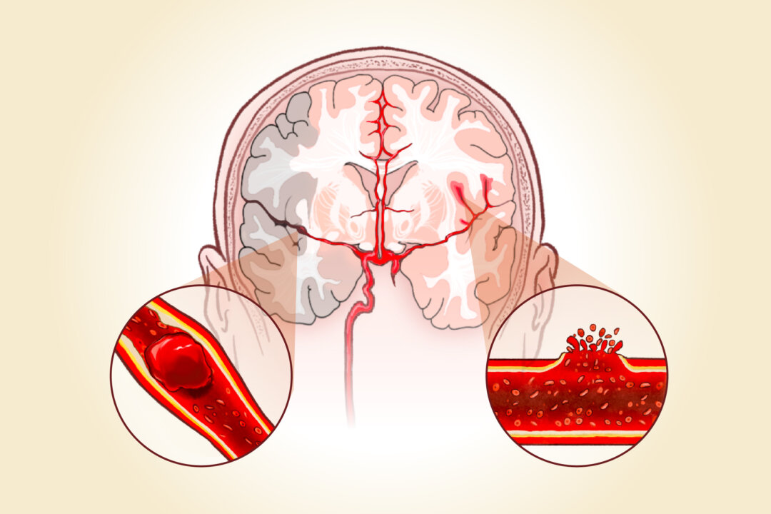 (Illustration by The Epoch Times, Shutterstock)