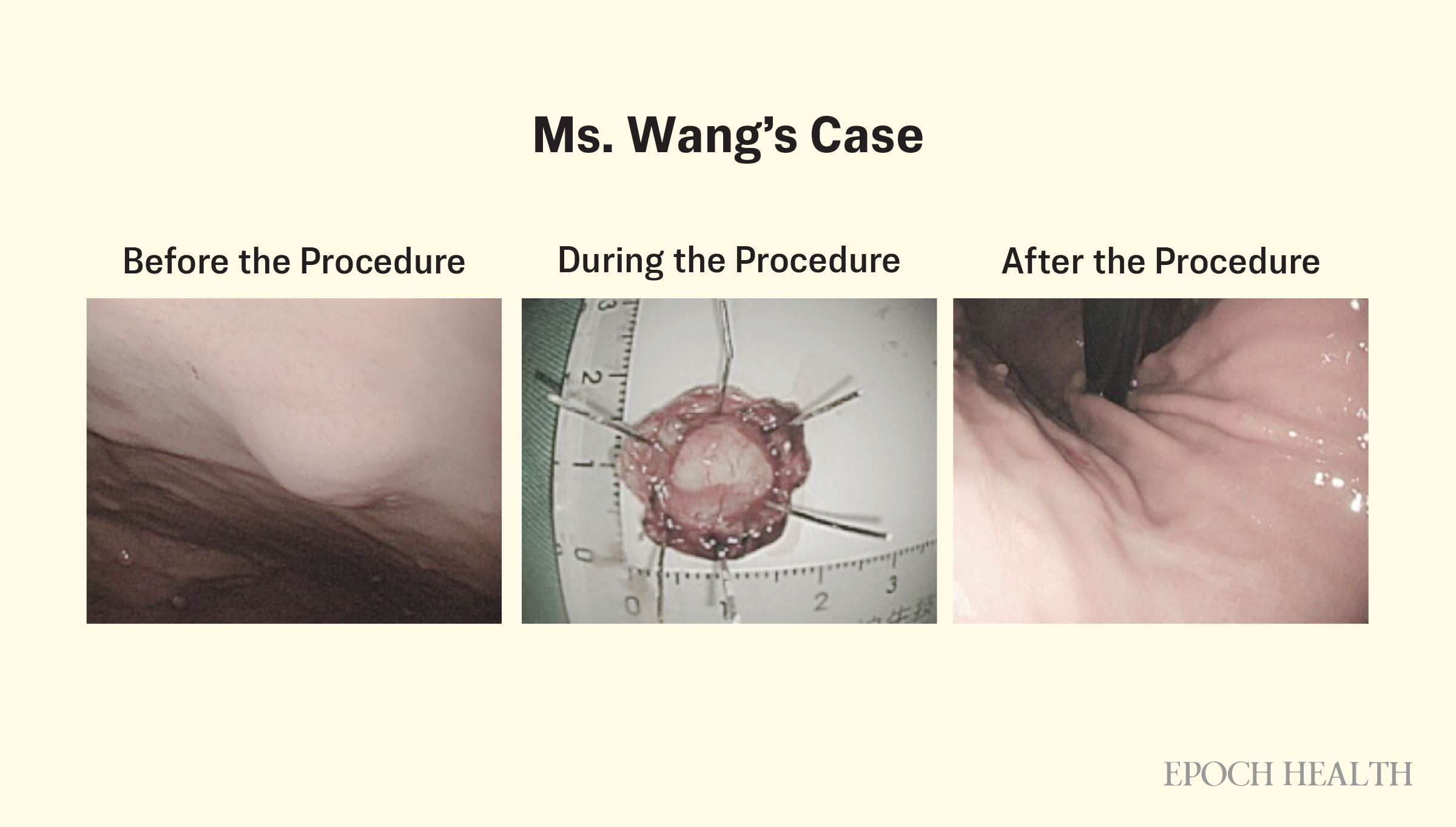 Ms. Wang’s case. (Photo courtesy of Hong-Yun Chen)