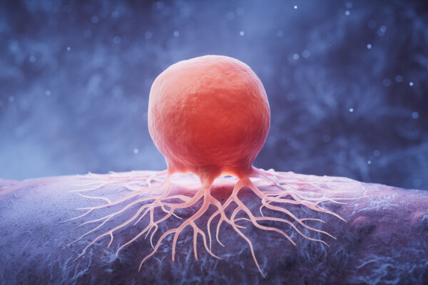 Cancer Is Not Just in Your Genes: Be Aware of These Key Culprits