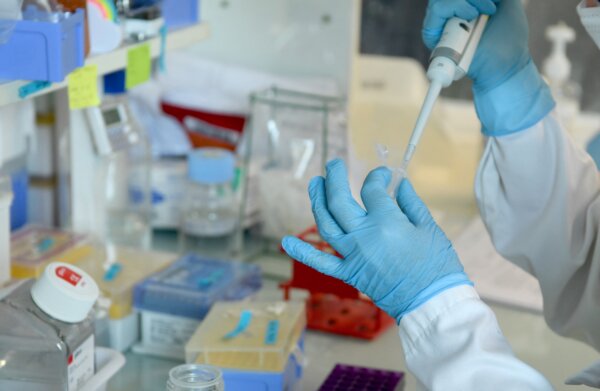 Breakthrough Gene Therapy Treats Huntington’s Disease for First Time