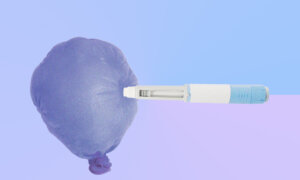 ‘Ozempic Face’ Rises With Rapid Weight Loss: What You Need to Know