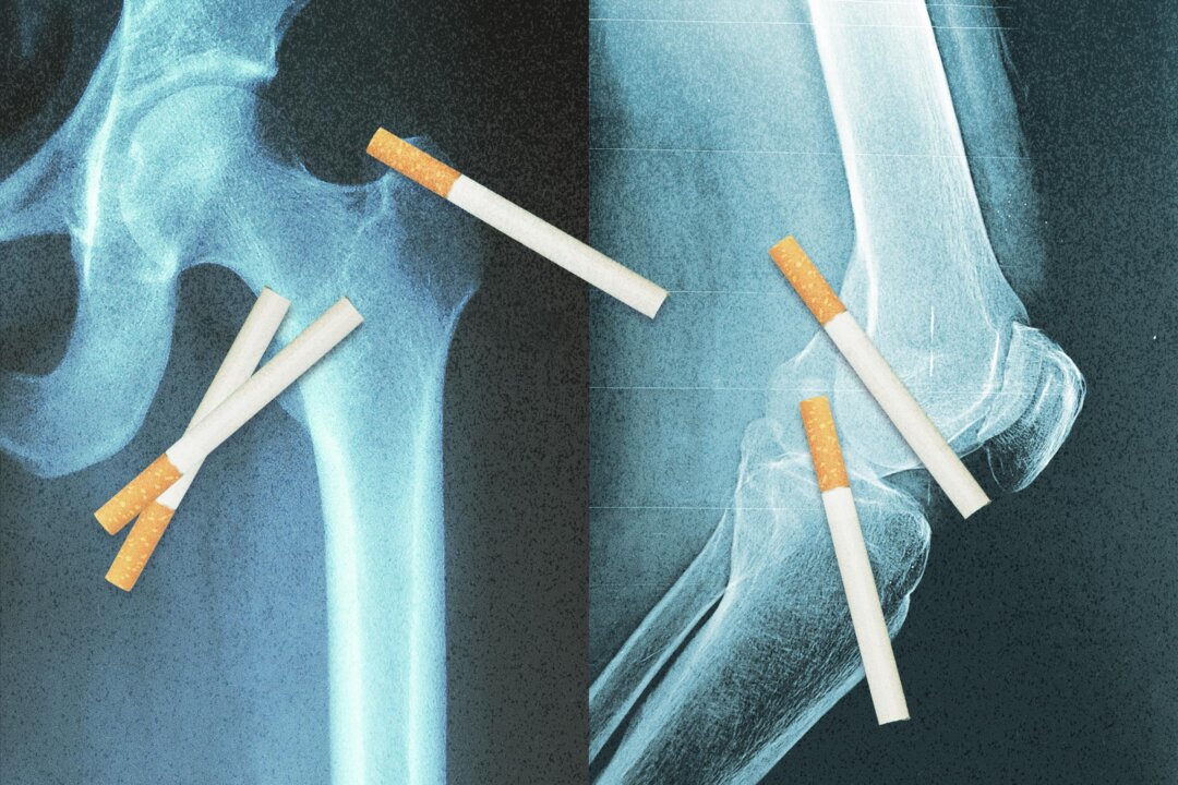 Science Deciphers: Your Bones ‘Remember’ the Cigarettes You Smoked