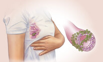 Breast Cancer: 2nd Most Common Cancer in Women–Here Are the Early Signs