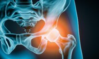 How to Know If It’s Time for a Hip Replacement