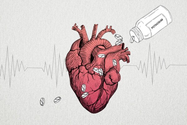 Raising Potassium Levels Helps Reduce Dangerous Heart Rhythms