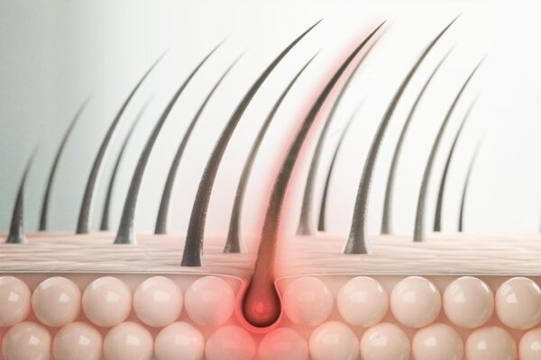 Simple Hair Test Identifies Children at Highest Risk for Depression and Anxiety