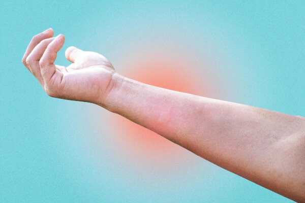 Simple Home Remedies for Burns, Cuts, and Insect Bites