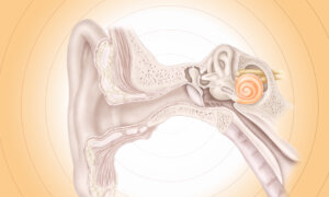 Tinnitus: Ringing or Buzzing Sounds Without an External Source–Here Are the Causes