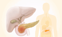 Pancreatic Cancer: A Silent and Deadly Cancer–Warning Signs to Watch For