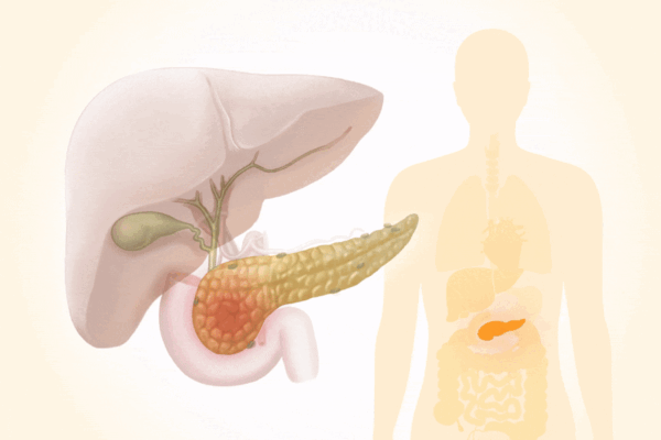 Pancreatic Cancer: A Silent and Deadly Cancer–Warning Signs to Watch For