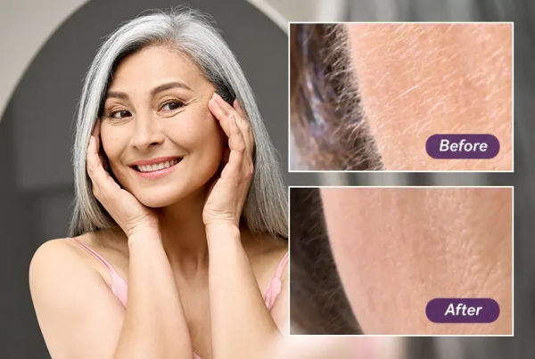 Sonicsmooth Pro+: How Women Over 40 Are Getting Smoother, Glowing Skin Without Medspa Visits