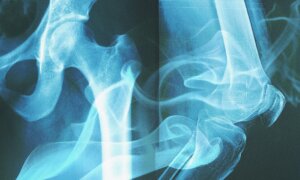 Your Bones ‘Remember’ the Cigarettes You Smoked