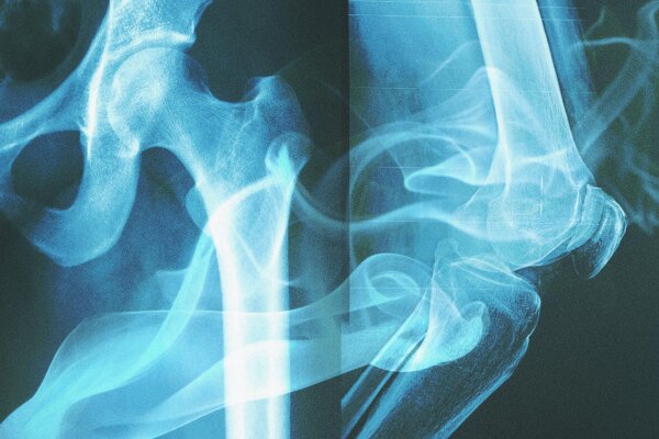 Study Uncovers Centuries-Old Impact of Smoking