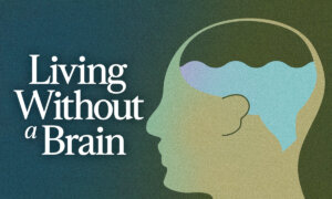 The Man Who Lived Without a Brain