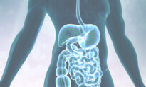 New Crohn’s Disease Guidelines Bypass Conventional Treatment for Advanced Therapy