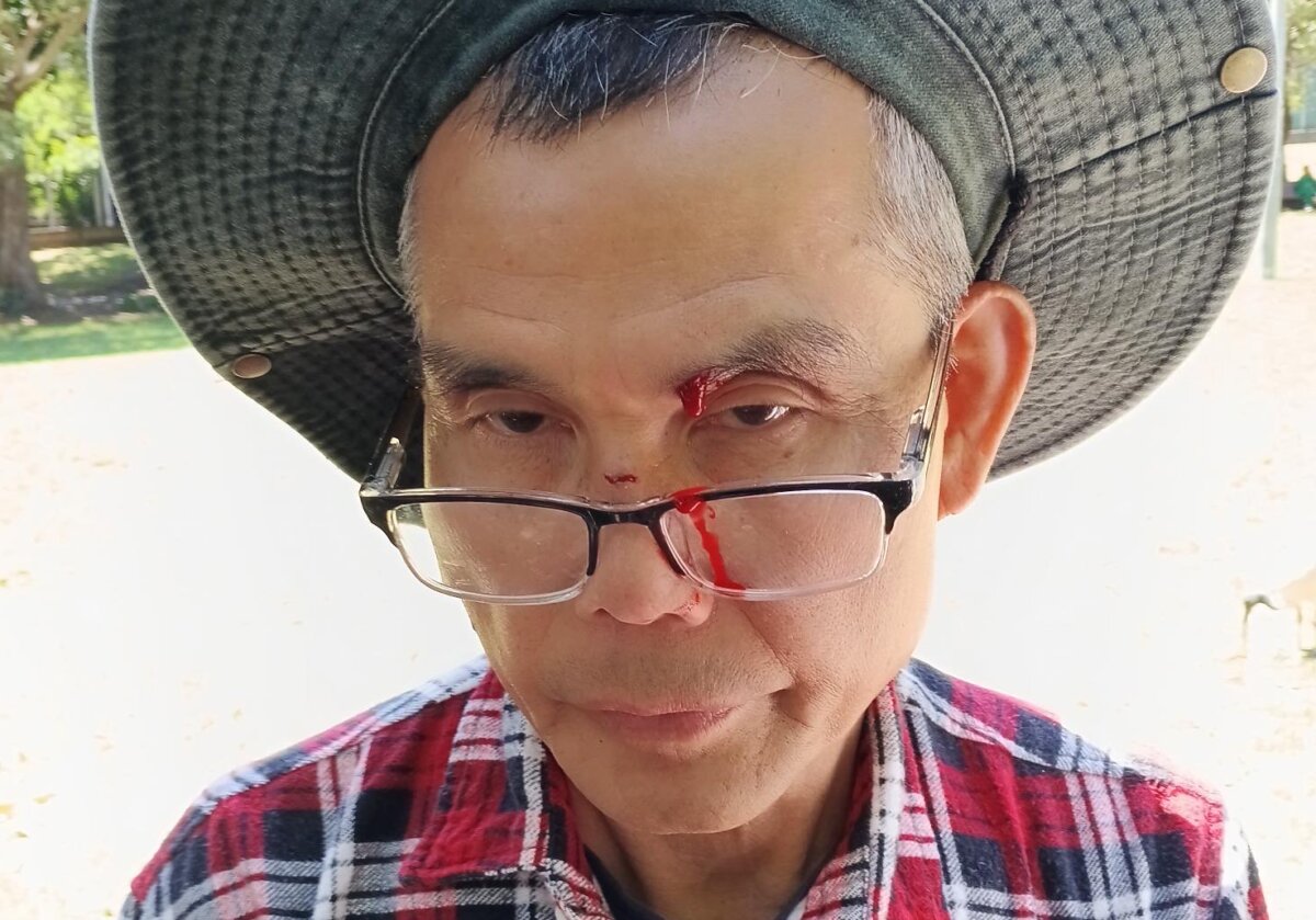 Li Kun, a Falun Gong practitioner who was struck with an empty bottle by Kane Hodges in Belmore Park, Sydney on Dec. 2, 2025. (Courtesy of Falun Gong practitioners)