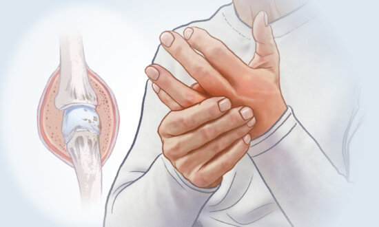 Rheumatoid Arthritis: When the Immune System Attacks Your Joints–Symptoms to Watch For