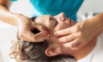 How Facial Acupuncture Can Help Rejuvenate Your Skin
