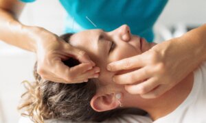 How Facial Acupuncture Can Help Rejuvenate Your Skin
