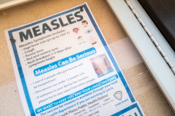 171 Measles Cases Already Reported in 2026
