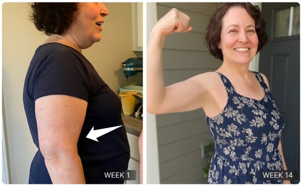 Non-Invasive Alternative for Smoother, Firmer Looking Skin Without Expensive Treatments