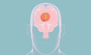 The Simple Depression Treatment We Don’t Prescribe